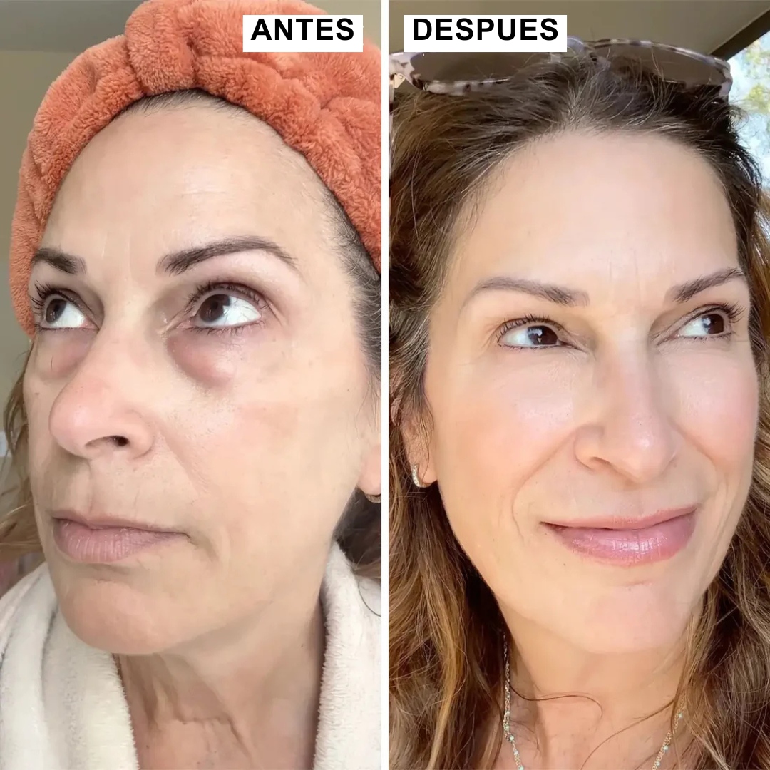 Bálsamo facial todo en uno CumaBalm™ |  mirada fresca y joven.